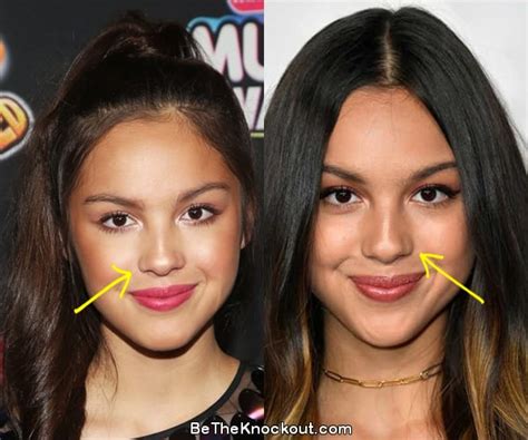 does olivia rodrigo have implants|Sneaky plastic surgeries used by celebs to look better than you